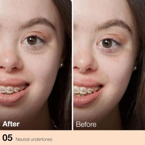  Conceal Bruises With Makeup