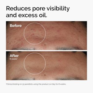 The Ordinary 10 Niacinamide Zinc