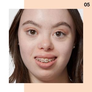How Conceal Bruises Makeup 